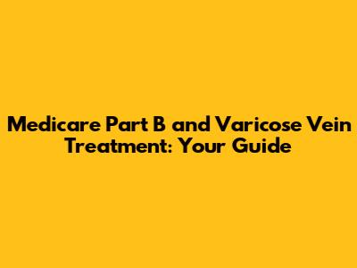 Medicare Part B and Varicose Vein Treatment: Your Guide